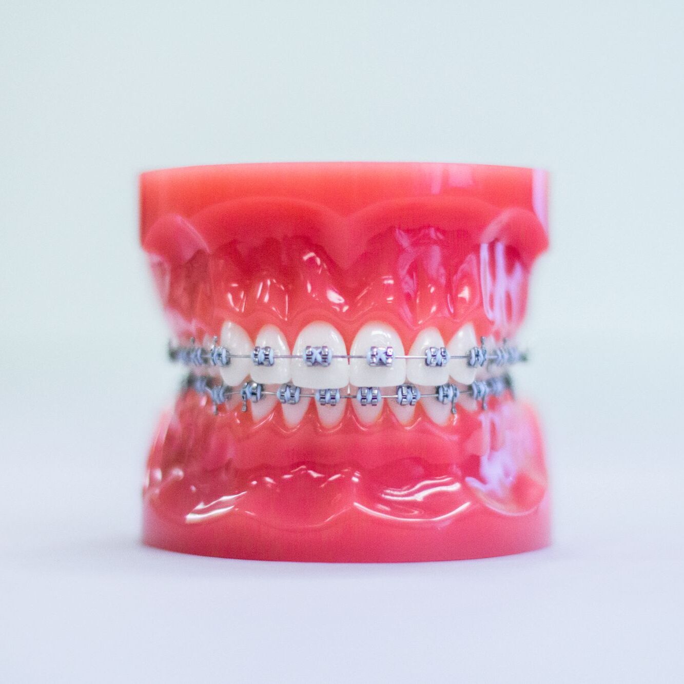 metal braces germantown